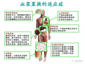 废土危行中的生命续航秘术：高效加血攻略与浆果大搜集宝典