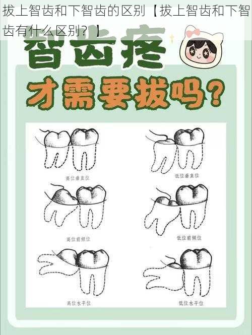 拔上智齿和下智齿的区别【拔上智齿和下智齿有什么区别？】