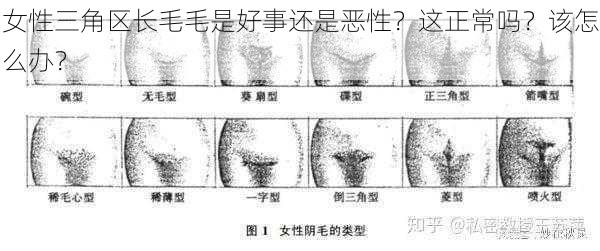 女性三角区长毛毛是好事还是恶性？这正常吗？该怎么办？